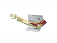 model dłoni z chorobą zwyrodnieniową stawów - 1019520 3b scientific modele anatomiczne 12